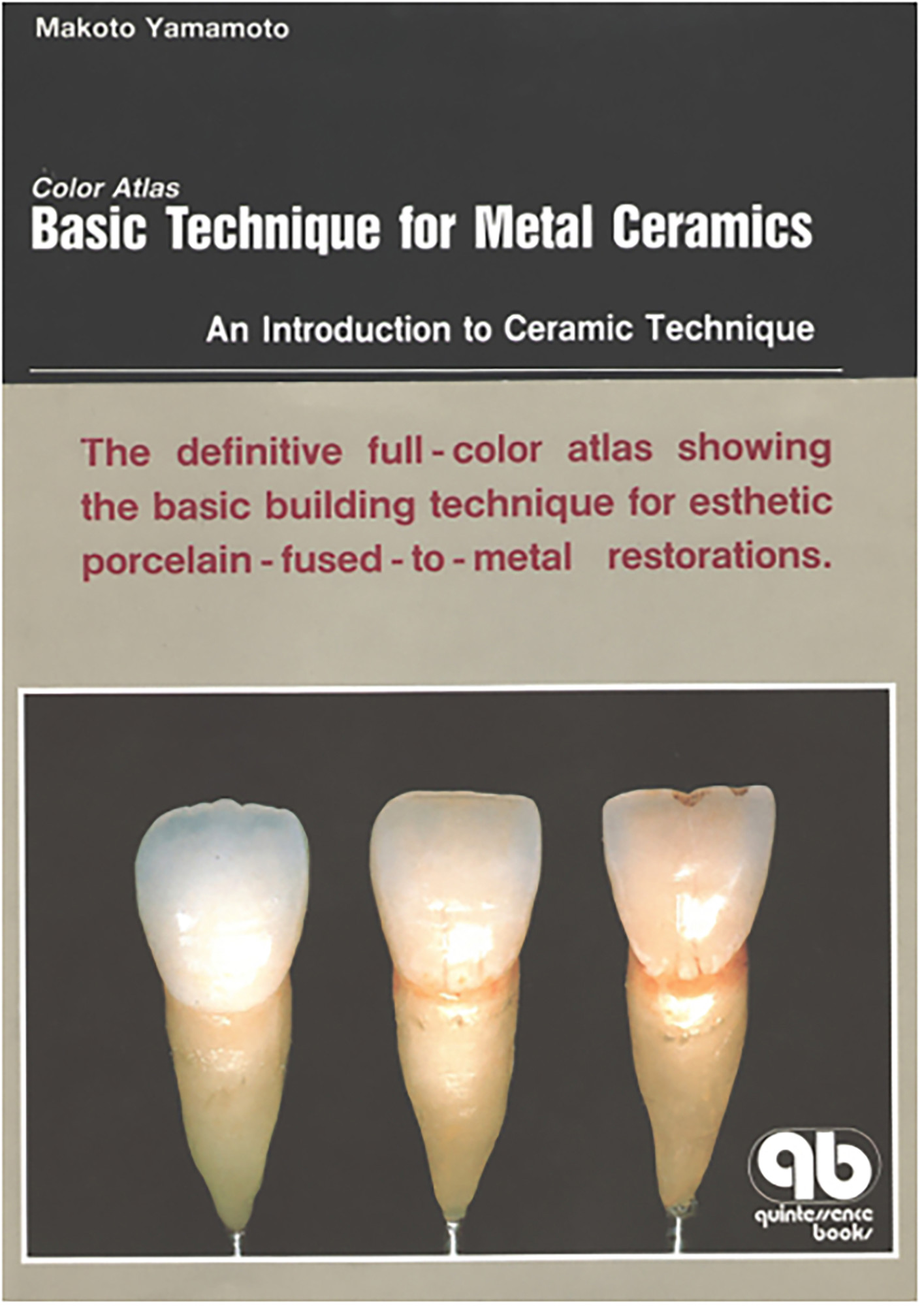 Color Atlas Basic Technique for Metal Ceramics