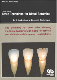 Color Atlas Basic Technique for Metal Ceramics - Makoto Yamamoto - ebook