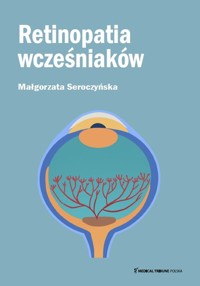 Retinopatia wcześniaków - Seroczyńska Małgorzata - książka