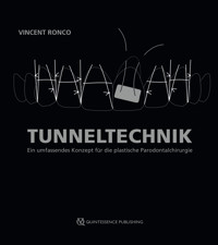 Tunneltechnik - Vincent Ronco - ebook