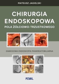 Chirurgia endoskopowa pola żółciowo-trzustkowego. Zabiegowa endoskopia pankreatobiliarna - Mateusz Jagielski - książka
