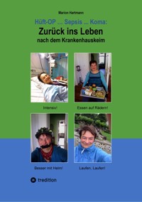 Hüft-OP ... Sepsis ... Koma: Zurück ins Leben nach dem Krankenhauskeim - Marion Hartmann - ebook