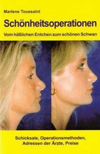 Schönheitsoperationen -Vom hässlichen Entchen zum schönen Schwan - Marlene Toussaint - ebook