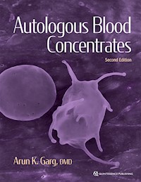 Autologous Blood Concentrates - Arun K. Garg - ebook