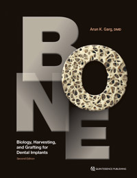 Bone - Arun K. Garg - ebook
