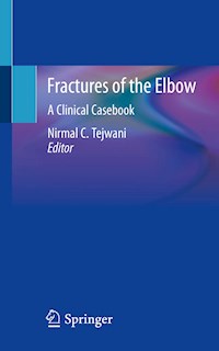 Fractures of the Elbow -  - ebook