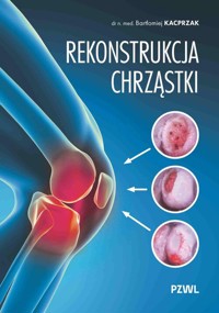 Rekonstrukcja chrząstki - Kacprzak Bartłomiej - książka