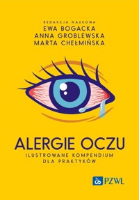 Alergie oczu. Ilustrowane kompendium dla praktyków - Ewa Bogacka, Anna Groblewska, Marta Chełmińska - książka