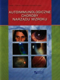 Autoimmunologiczne choroby narządu wzroku - Kański Jacek J., Kubicka-Trząska Agnieszka - książka