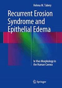 Recurrent Erosion Syndrome and Epithelial Edema - Helena M. Tabery - ebook