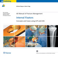 AO Manual of Fracture Management: Internal Fixators - Michael Wagner - ebook