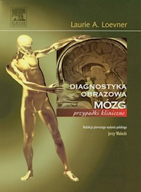 Mózg - Loewner Laurie A. - książka