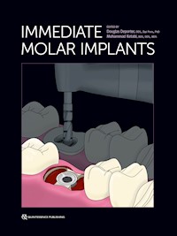 Immediate Molar Implants - Douglas Deporter - ebook