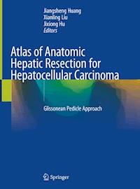 Atlas of Anatomic Hepatic Resection for Hepatocellular Carcinoma -  - ebook