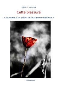 Cette blessure - Frédéric Hoebeeck - ebook