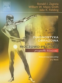 Diagnostyka obrazowa. Układ moczowo-płciowy - Zagoria Ronald J., Mayo-Smith William M., Fielding Julia R. - książka