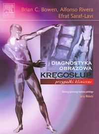 Kręgosłup Przypadki kliniczne - Bowen Brian C., Rivera Alfonso, Saraf-Lavi Efrat - książka