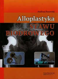 Alloplastyka stawu biodrowego - Pozowski Andrzej - książka