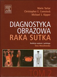 Diagnostyka obrazowa raka sutka Tom 2 - Tartar Marie, Comstock Christopher E., Kipper Michael S. - książka