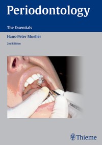 Periodontology - Hans-Peter Müller - ebook