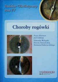Choroby rogówki Tom 4 -  - książka