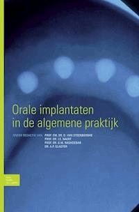 Orale implantaten in de algemene praktijk -  - ebook
