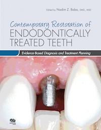 Contemporary Restoration of Endodontically Treated Teeth - Nadim Z. Baba - ebook