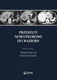 Przerzuty nowotworowe do wątroby - Marek Krawczyk - książka