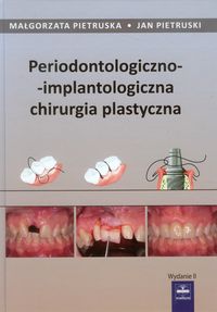 Periodontologiczno-implantologiczna chirurgia plastyczna - Pietruska Małgorzata, Pietruski Jan - książka