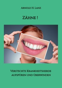 Zähne! - Arnold H. Lanz - ebook