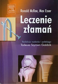 Leczenie złamań - McRae Ronald, Esser Max - książka