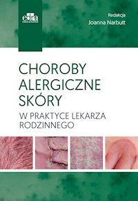 Choroby alergiczne skóry w praktyce lekarza rodzinnego -  - książka