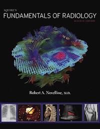 Squire's Fundamentals of Radiology - Novelline Robert A. - książka