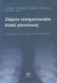 Zdjęcia rentgenowskie klatki piersiowej - Corne J., Carroll M., Brown I., Delany D. - książka