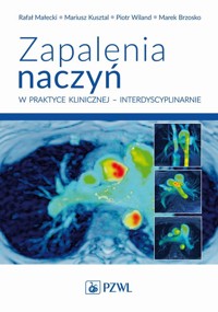 Zapalenia naczyń w praktyce klinicznej interdyscyplinarnie - Małecki Rafał, Kusztal Mariusz, Wiland Piotr, Brzosko Marek - książka