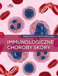 Immunologiczne choroby skóry - Pituch-Noworolska A. - książka