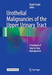 Urothelial Malignancies of the  Upper Urinary Tract -  - ebook