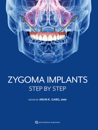 Zygoma Implants - Arun K. Garg - ebook
