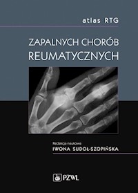 Atlas RTG zapalnych chorób reumatycznych -  - książka
