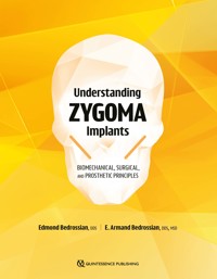 Understanding Zygoma Implants - Edmond Bedrossian - ebook
