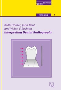 Interpreting Dental Radiographs - Keith Horner - ebook