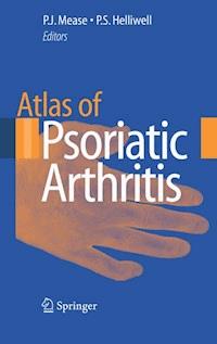 Atlas of Psoriatic Arthritis -  - ebook