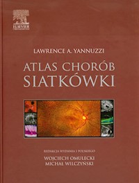 Atlas chorób siatkówki - Yannuzzi Lawrence A. - książka