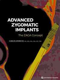 Advanced Zygomatic Implants - Carlos Aparicio - ebook