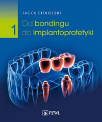 Od bondingu do implantoprotetyki. Część 1 - Jacek Ciesielski - książka