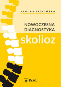 Nowoczesna diagnostyka skolioz - Sandra Trzcińska - książka