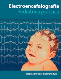 Electroencefalografía Pediatría Práctica - Graciela Del Pilar Guerrero Ruiz - ebook