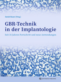 GBR-Technik in der Implantologie -  - ebook