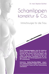 Schamlippenkorrektur & Co. - Intimchirurgie für die Frau - Stephan Günther - ebook