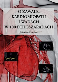 O zawale kardiomiopatii i wadach w 100 echoszaradach - Mirosław Kowalski - książka